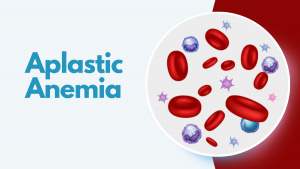Aplastic Anemia