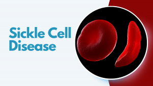 sickle cell