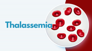 thalasamia